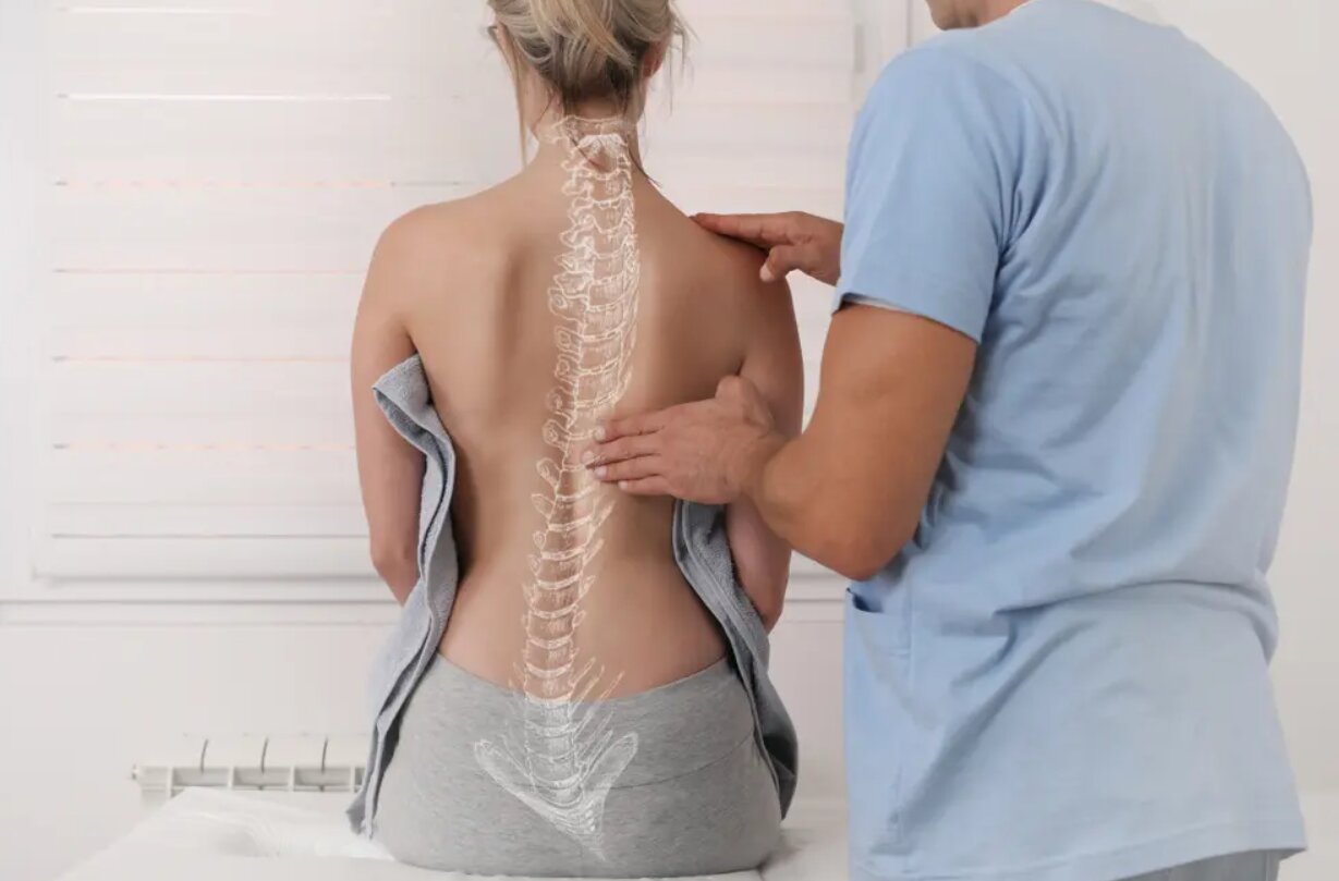 a woman with scoliosis
