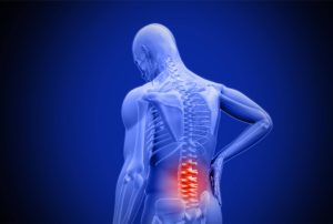 man having back issues